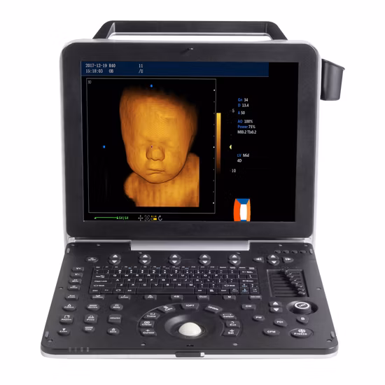 4D 5D Color Ultrasonic Diagnostic Apparatus, Portable Color Doppler Ultrasound Scanner Mslcu64