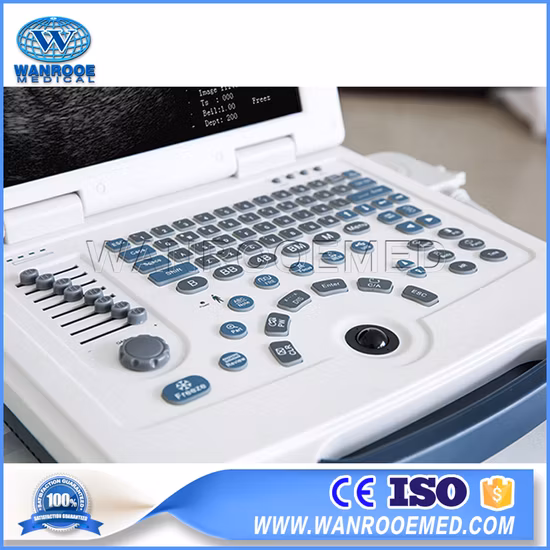 Digital Portable Ultrasonic Diagnosis Equipment Ultrasound Scanner